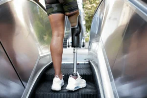 Workers' Comp vs. Third-Party Claims for Workplace Machinery Amputations